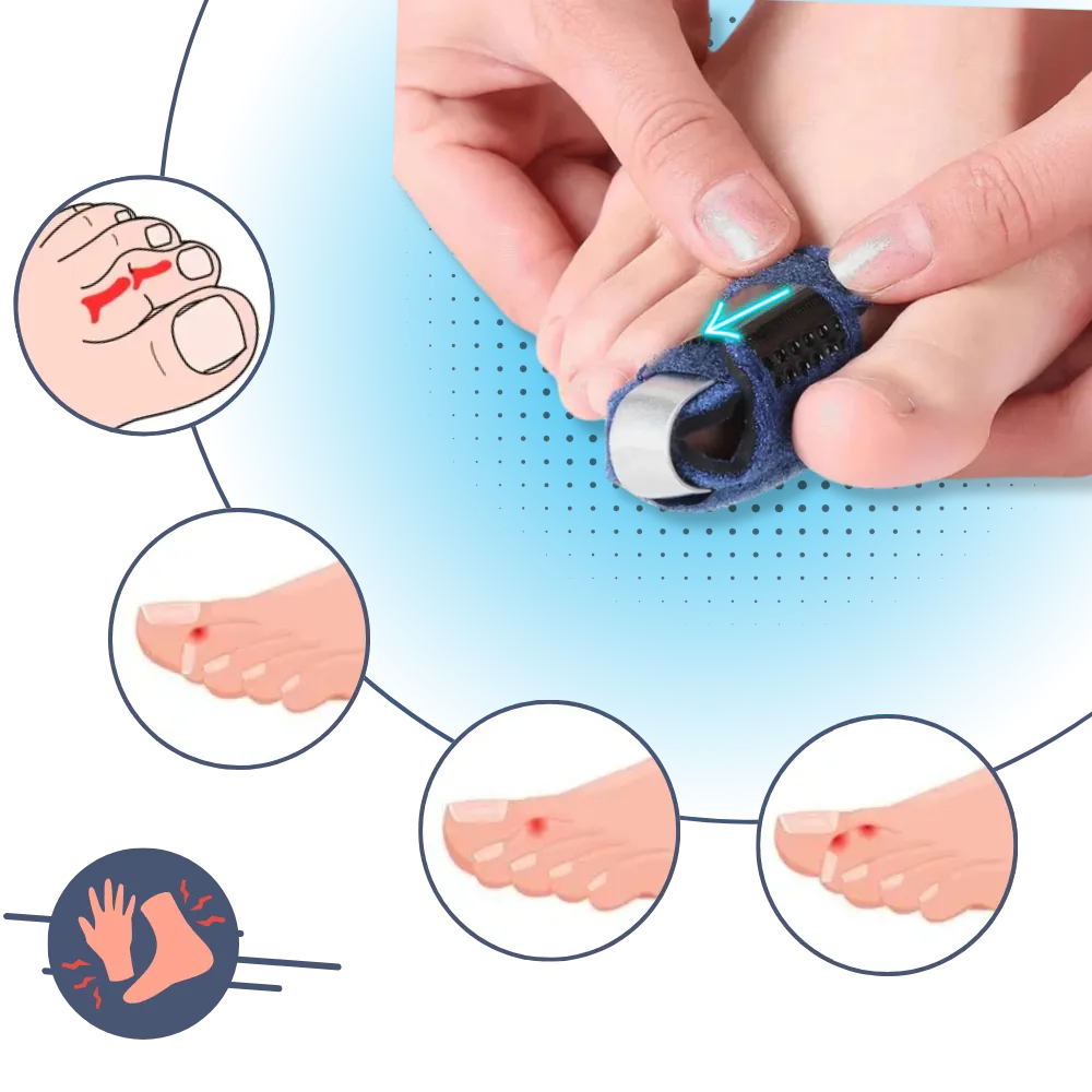 Adjustable & Discreet Fit Toe Straightener