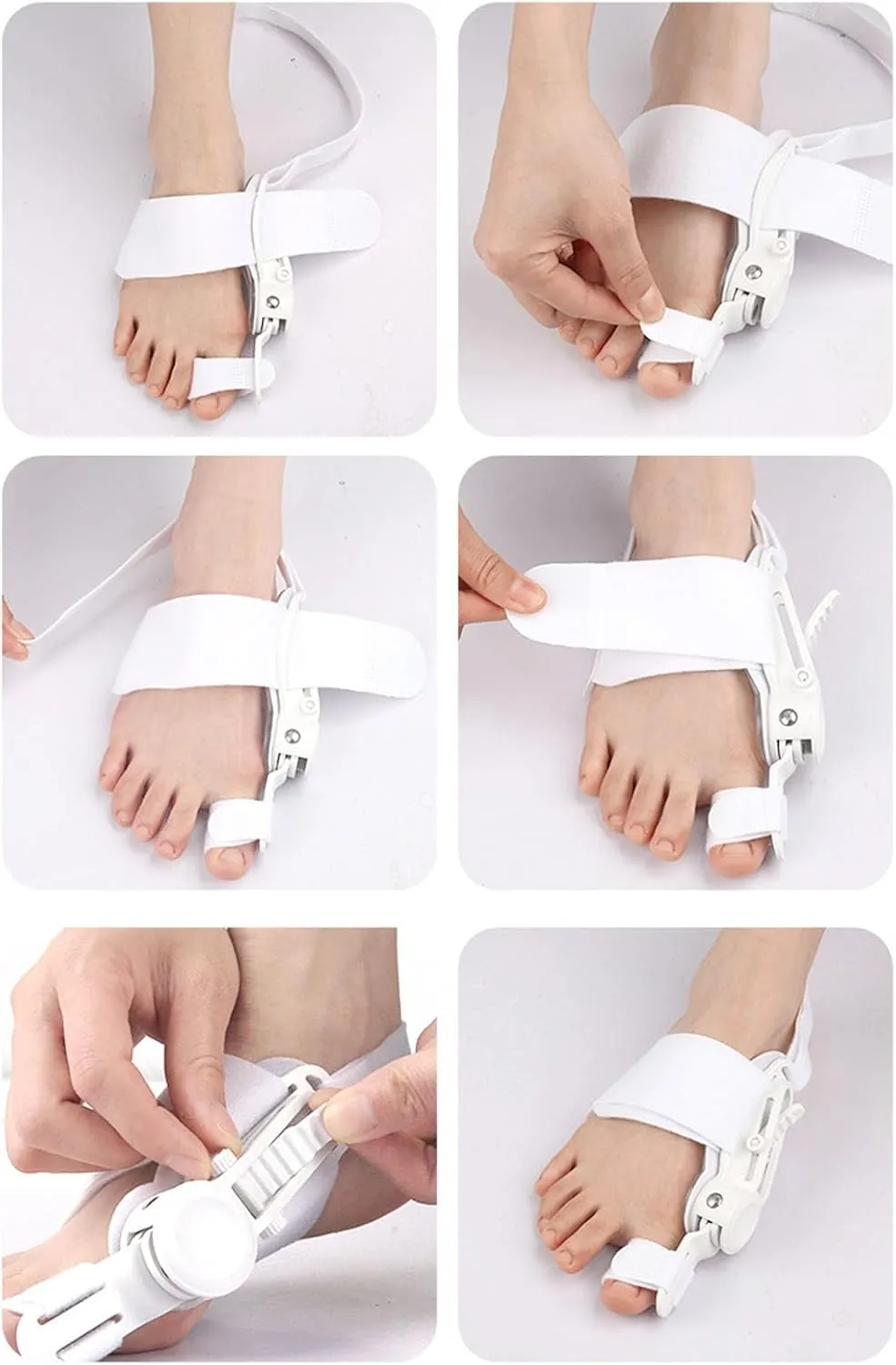 AlignRelief™ Adjustable Bunion Corrector