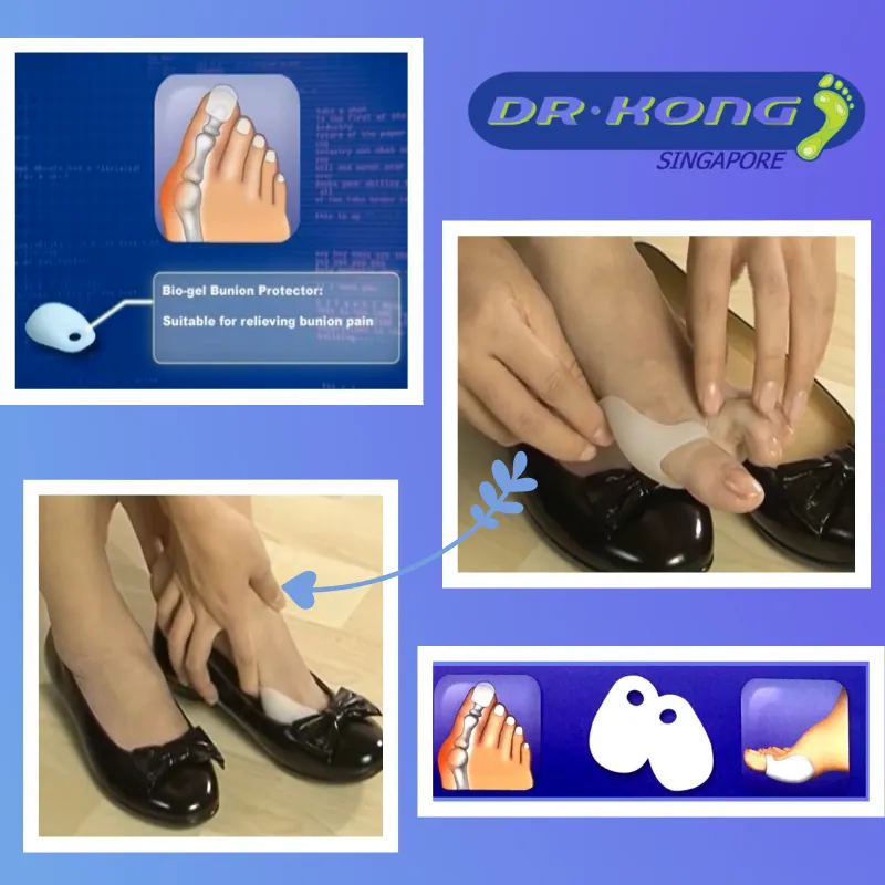 DR.KONG BIO-GEL BUNION PROTECTOR ACCESSORIES DK-DKA10-F