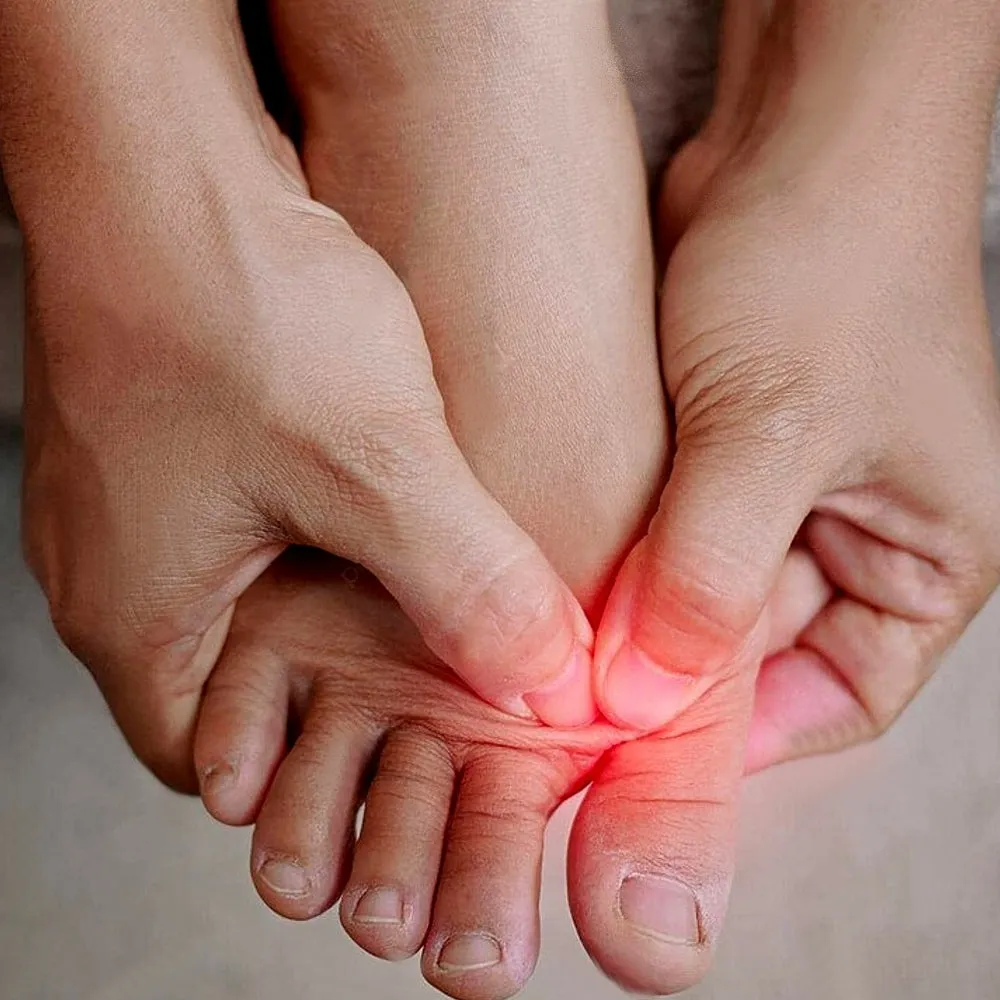 Easiest Way To Relieve Bunion Pain