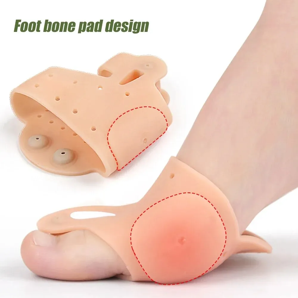 Easiest Way To Relieve Bunion Pain