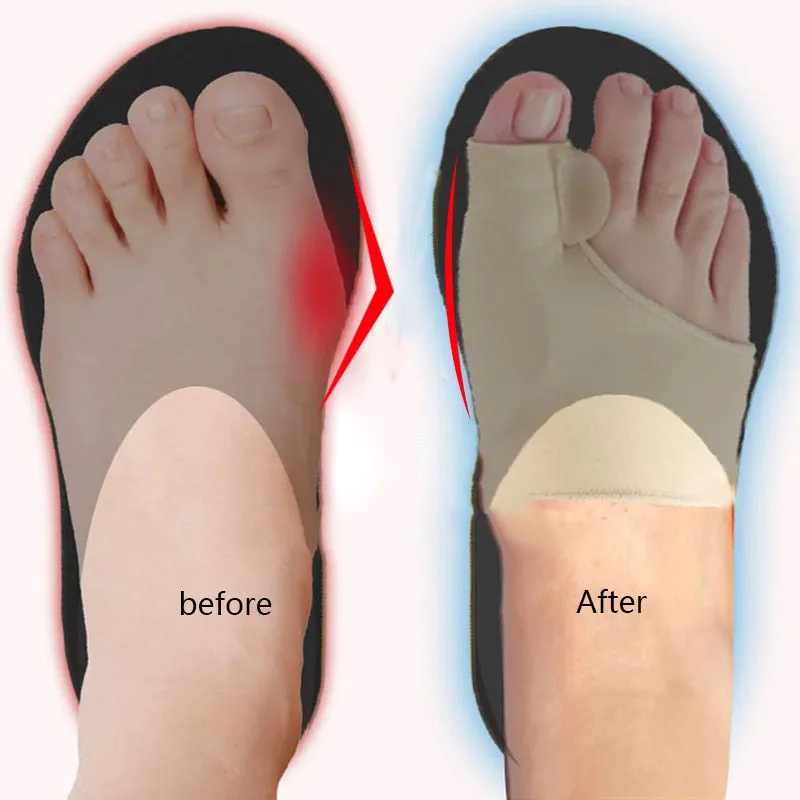 Thumb Adjuster Correction Pedicure Socks Straightener
